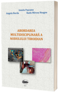 Abordarea multidisciplinara a nodulului tiroidian