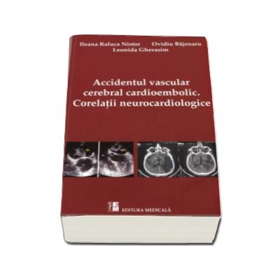 Accidentul vascular cerebral cardioembolic. Corelatii neurocardiologice - Leonida Gherasim