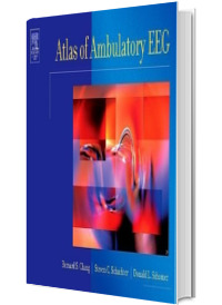 Atlas of ambulatory EEG