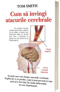 Cum sa invingi atacurile cerebrale