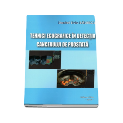 Daniel Liviu Badescu - Tehnici ecografice in detectia cancerului de prostata