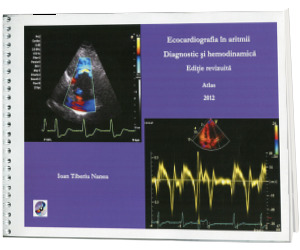 Ecocardiografia in aritmii. Editie revizuita, Atlas 2012