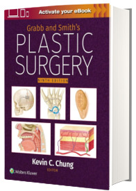 Grabb and Smith s Plastic Surgery: Print + eBook with Multimedia