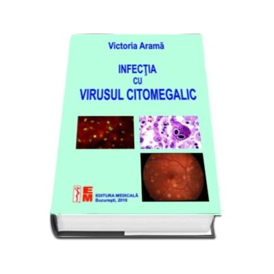 Infectia cu virusul citomegalic - Victoria Arama