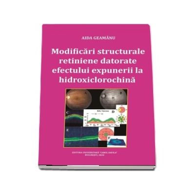 Modificari structurale retiniene datorate efectului expunerii la hidroxiclorochina