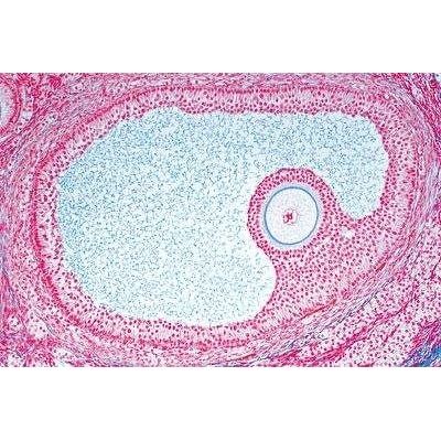 Sectiuni microscopice Sistemul genital
