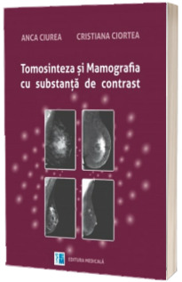 Tomosinteza si mamografia cu substanta de contrast