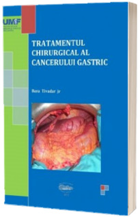 Tratamentul chirurgical al cancerului gastric. Alb-negru