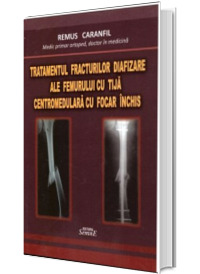 Tratamentul fracturilor diafizare ale femurului cu tija centromedulara cu focar inchis
