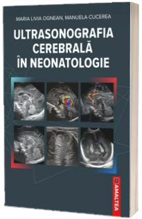 Ultrasonografia cerebrala in neonatologie